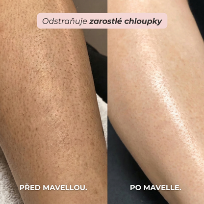 Mavella™ | Dámský zastřihovač 2 v 1 pro intimní partie a tělo
