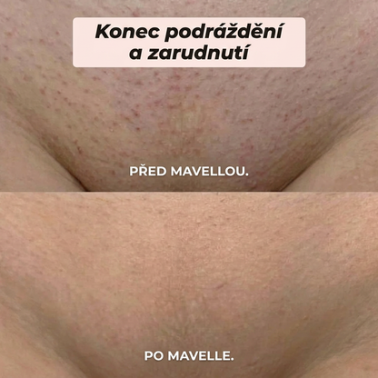 Mavella™ | Dámský zastřihovač 2 v 1 pro intimní partie a tělo